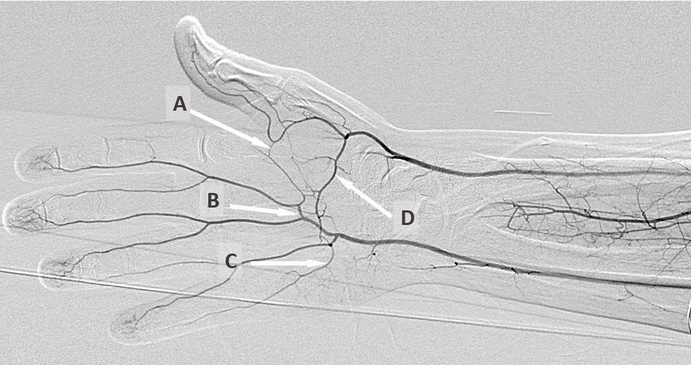 Interventional Radiology